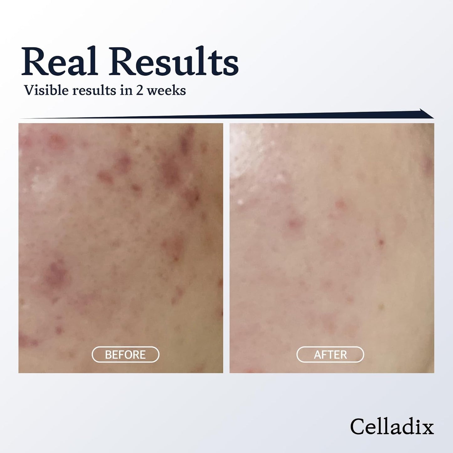 CELLADIX SKIN BALANCING PH 5.5 TONER MIST