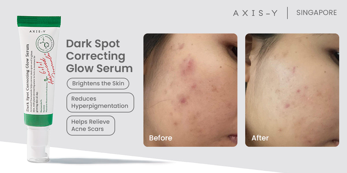 AXIS-Y DARK SPOT CORRECTING GLOW SERUM