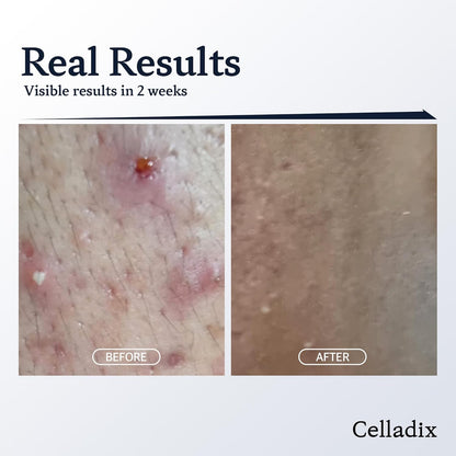 CELLADIX SKIN BARRIER RECOVERY 131 CREAM